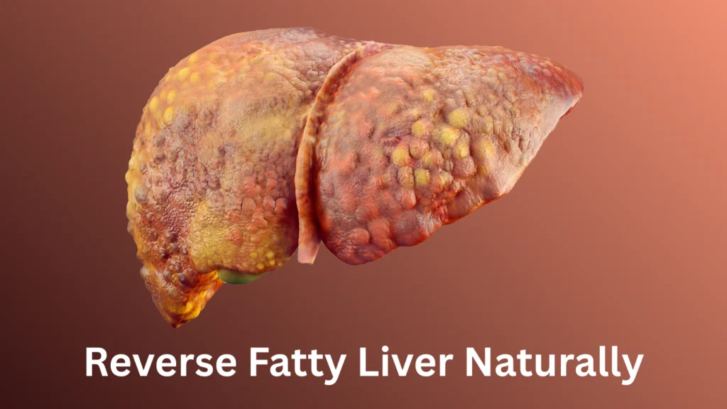 Reverse Fatty Liver Naturally