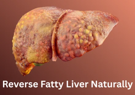 Reverse Fatty Liver Naturally