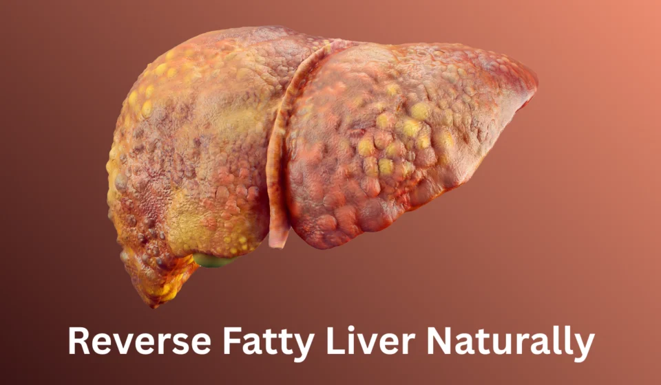 Reverse Fatty Liver Naturally